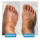 Postur™- Masajeador de pies