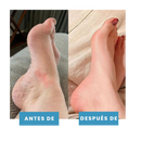 Postur™- Masajeador de pies